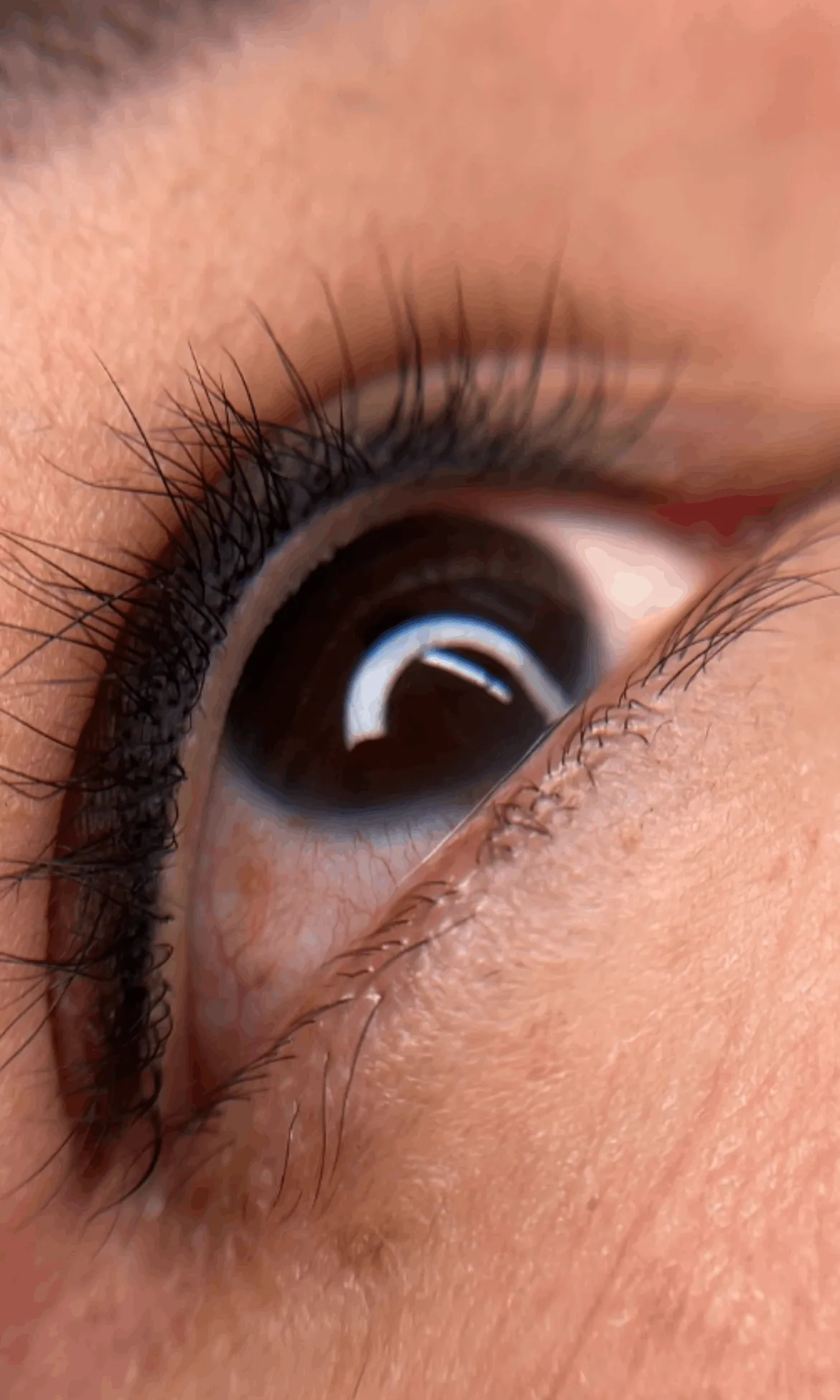 Межресничка Межресничка